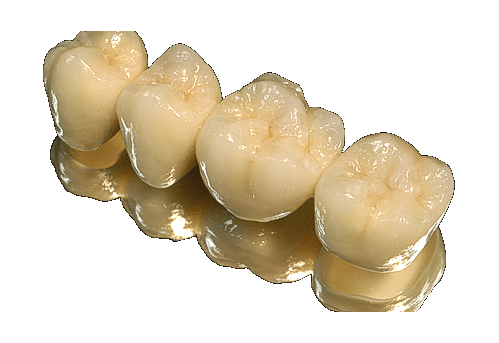 Είναι αποδοτική η τεχνολογία CAD/CAM;