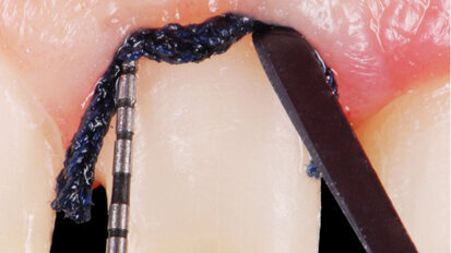 The new frontier restorative dentistry