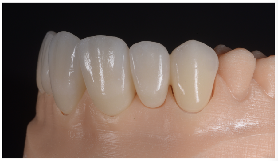 Fig. 26b_Finalizzazione del lavoro sul modello.