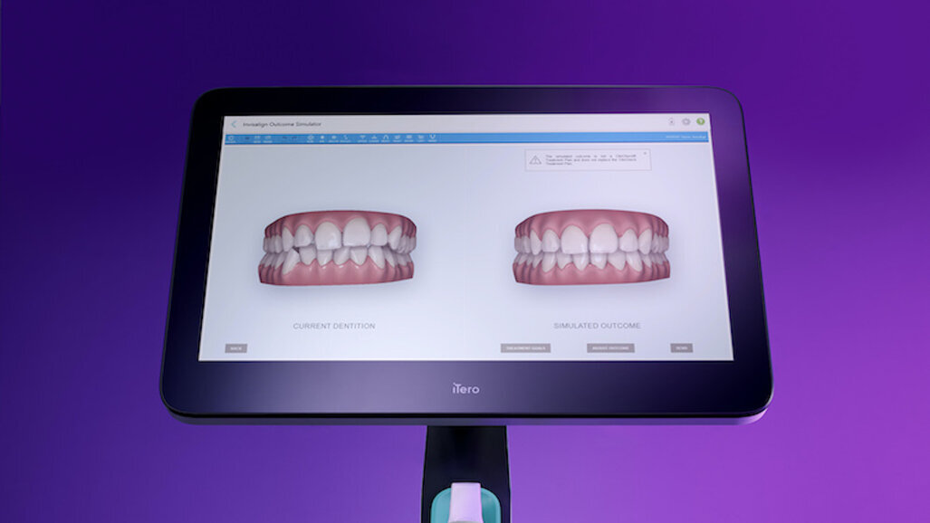 iTero Element Plus Serisi, Türkiye'de Kullanıma Sunuldu