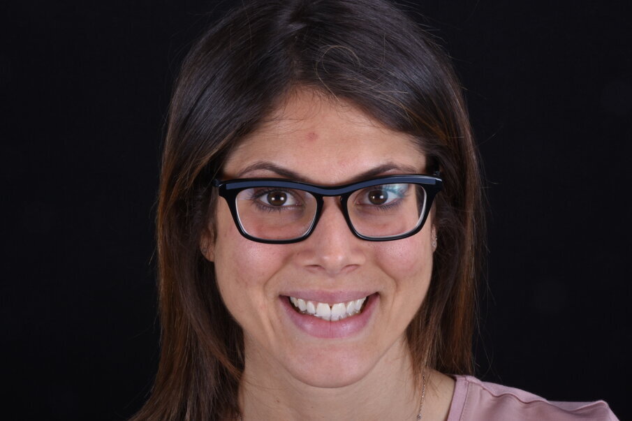 Fig. 6 - Sorriso di circostanza dopo risoluzione estetico clinica.