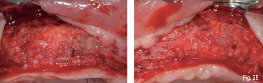 Fig. 28