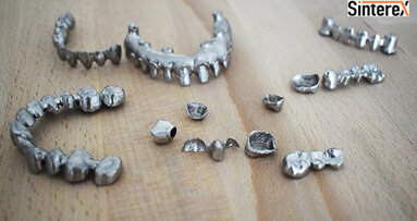 Metal 3D Printed Frameworks for PFM crowns and bridges