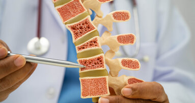 Periodontitis may worsen systemic bone loss via gut microbiota