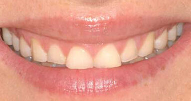 Invasivité minimale – Efficacité maximale