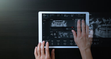 Artificial intelligence-based tool shows accuracy in segmentation of impacted maxillary canines
