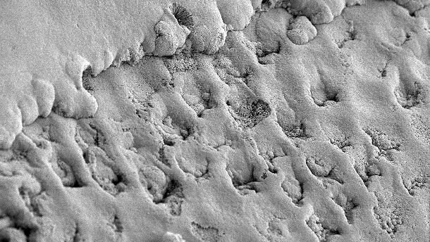 Zahnschädigung durch alkalische Substanzen nachgewiesen