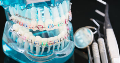 Orthodontic treatment not associated with overall happiness, study finds