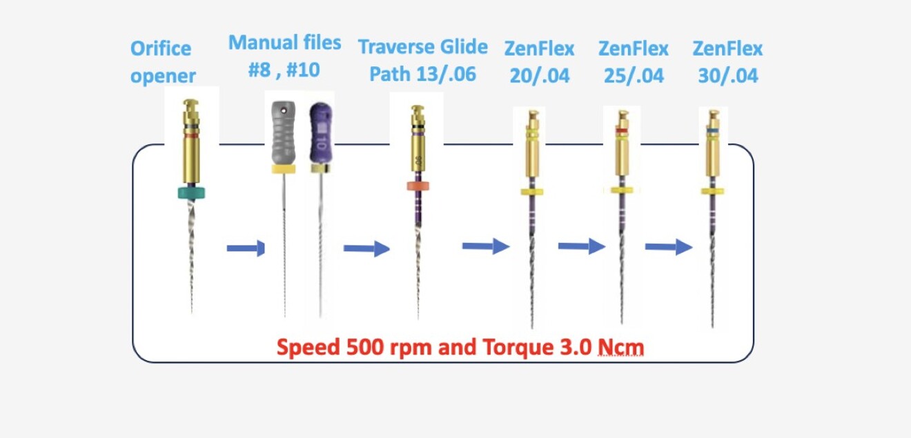 Fig. 10: Full rotation sequence using the Traverse and ZenFlex file systems.