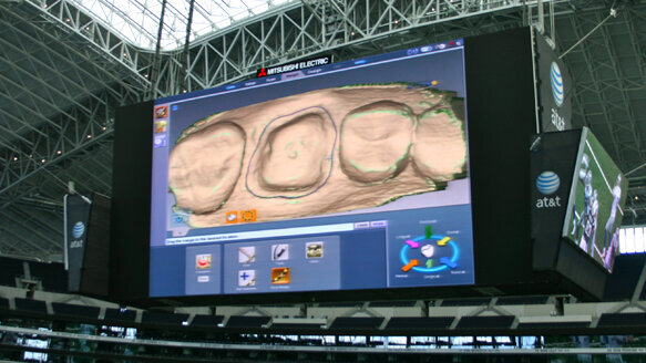 CADapalooza meeting scores touchdown for digital dentistry