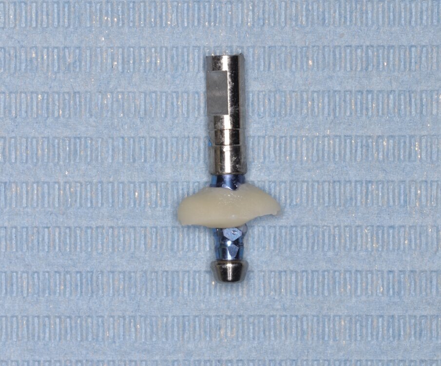 Fig. 21 - Costruzione di un transfer individualizzato per replicare il tragitto transmucoso.