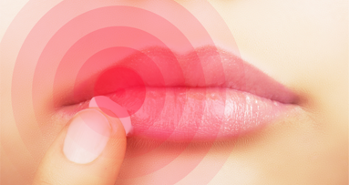 Jeder zweite Österreicher hatte schon mal Fieberbläschen