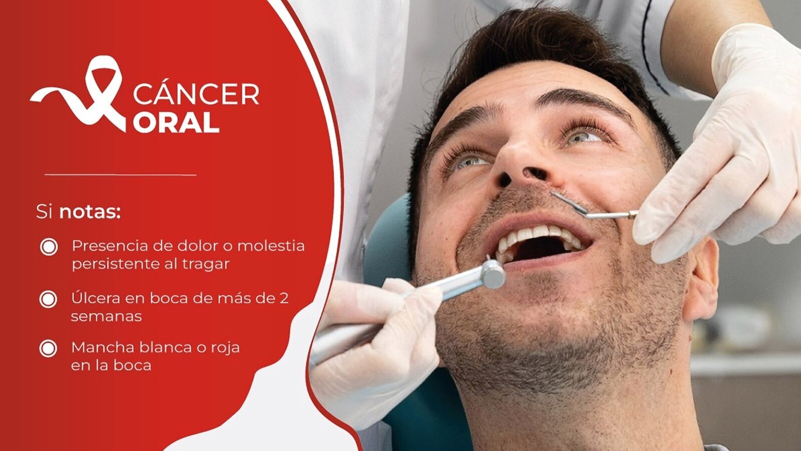 Lanzan Campaña de Cáncer Oral   
