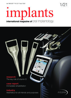 implants international No. 1, 2021 implants international No. 1, 2021