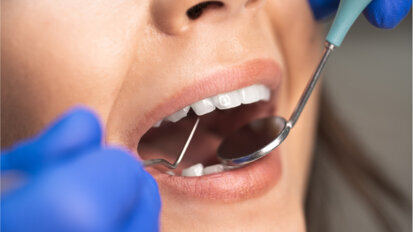 Kostenzuschüsse für Parodontitisbehandlung