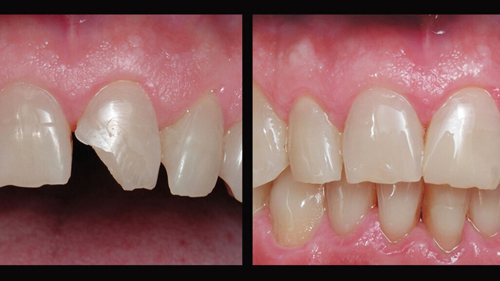 Imitando la naturaleza