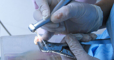 Reimplante intencional