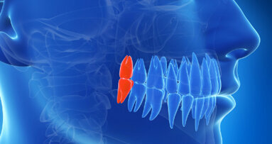 ADF 2014 : conférence « La dent de sagesse »