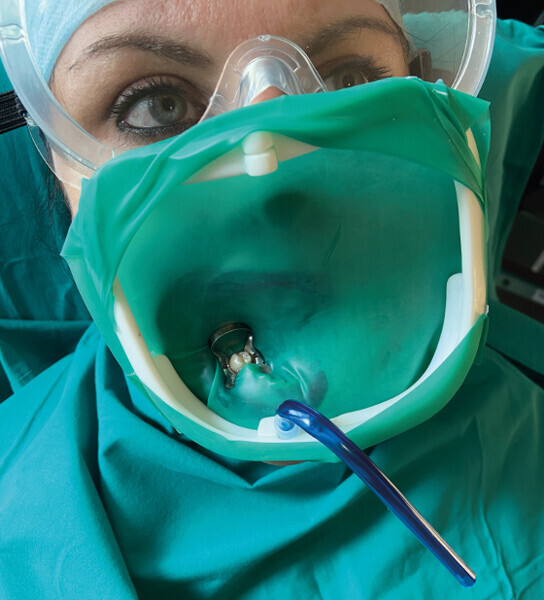 Fig. 14 : Liquide d’irrigation montrant l’étanchéité et modification du renfort et de la crépine d’aspiration. 