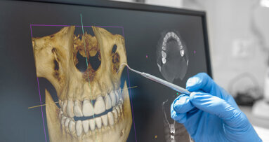 A new era in US dental imaging: AI-driven, safe and patient-centric solutions