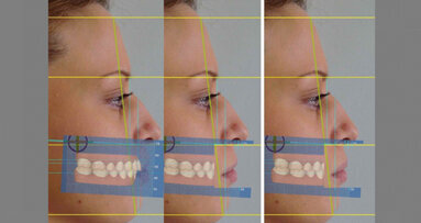 Analisi estetica dento-facciale con l’uso di software 3D: sinergia tra Medicina e Odontoiatria estetica