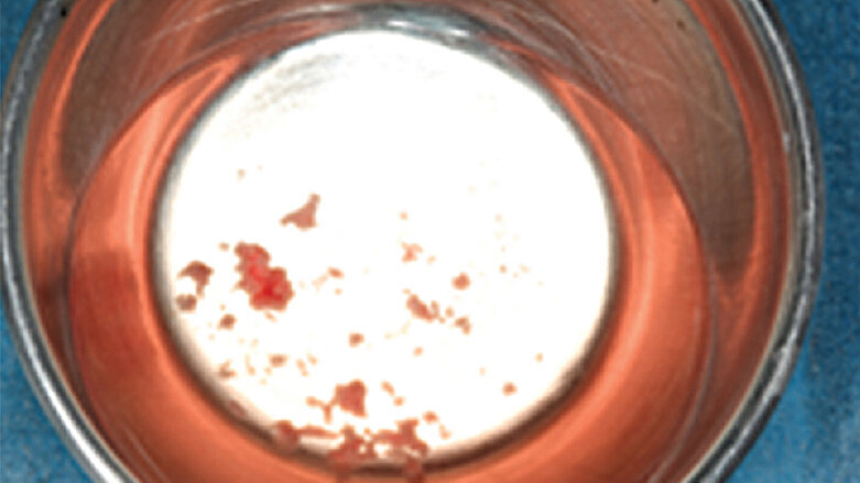 Biomateriales naturales