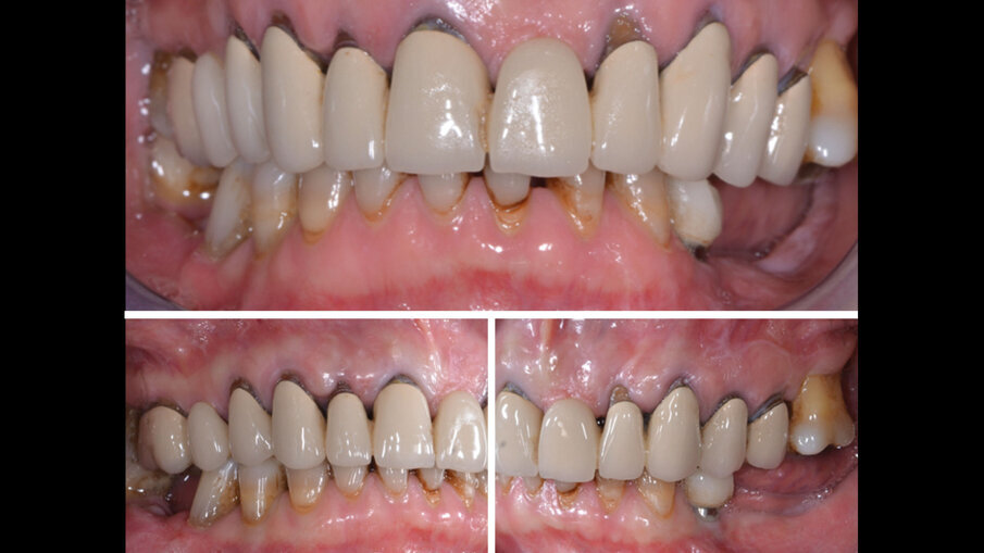 Fig. 2 - Immagini intraorali.