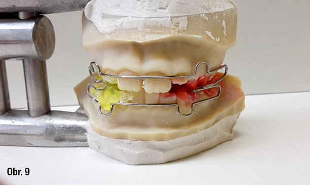 Vytvoření těla aparátu