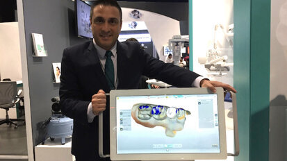 MyCrown, restauraciones en dos horas desde el sillón