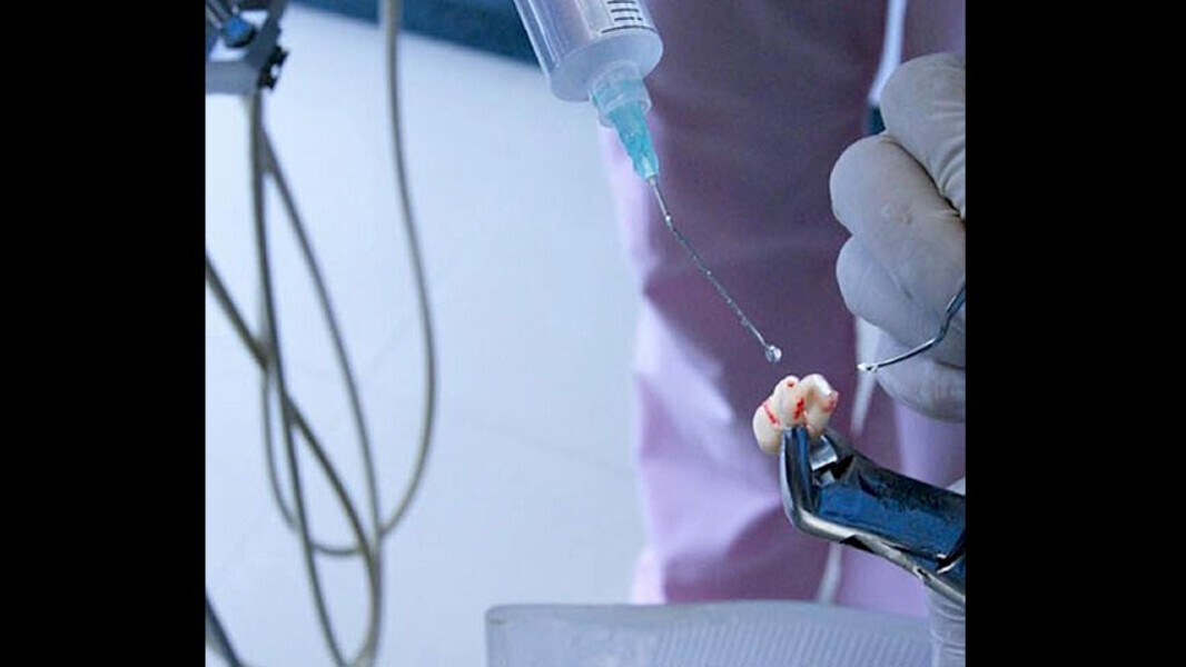 Figura 5. Preparación apical, sellado y reimplantación.