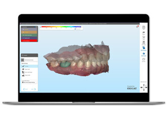 Align Technology – iTero Design Suite