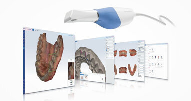 Planmeca Romexis CAD/CAM module takes digital impressions to the next level