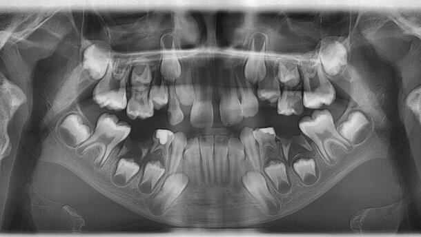 Przyszłość radiologii stomatologicznej