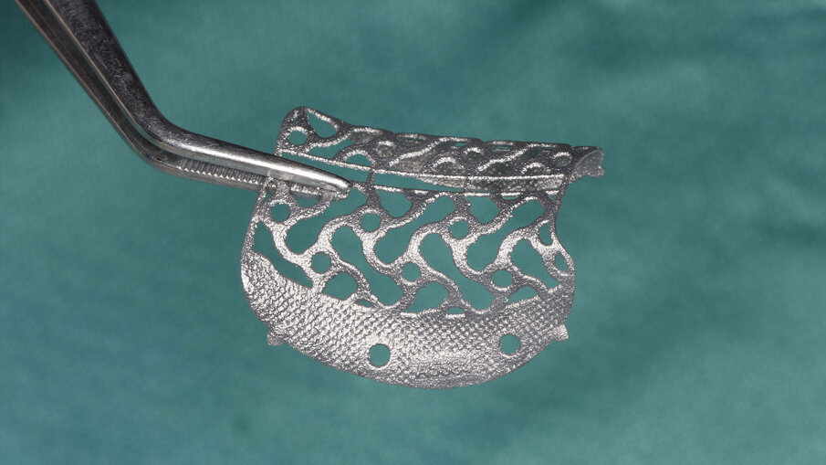 Fig. 3_Fotografia che mostra la griglia sterile prima dell’inserimento nella sede da ricostruire.