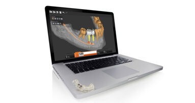 SimPlant® GO: il nuovo approccio all’implantologia dentale guidata