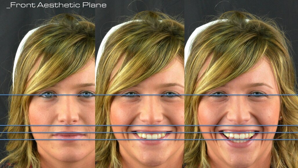 El diseñador digital de sonrisas