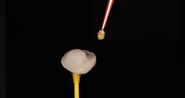 A new endo-resto approach in digital dentistry