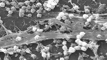 Beschermende coating vermindert aanhechting bacteriën