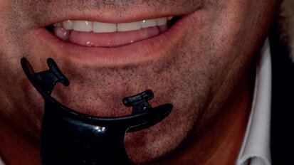 La concordance dei protocolli operativi domiciliari e professionali per il benessere del sorriso in un paziente che pratica sport agonistici: case report