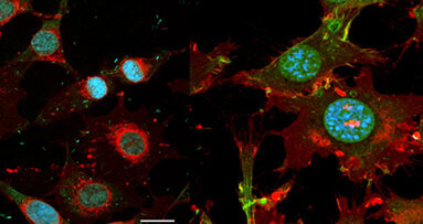 Forscher entwickeln keimreduzierende Implantate