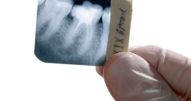 Carestream Health podwyższa ceny filmów do badań  radiologicznych