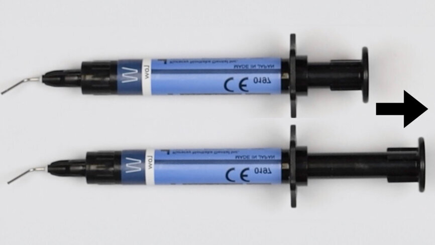 Retracting the plunger after administering the composite may cause air to enter the syringe. (Image: Kuraray Noritake Dental) 