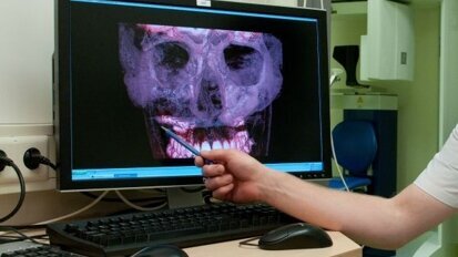 Beperkingen en valkuilen van CBCT