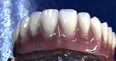 Economizando en la compra de materiales dentales