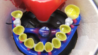 Interazioni tra i materiali di rivestimento per fusioni e leghe