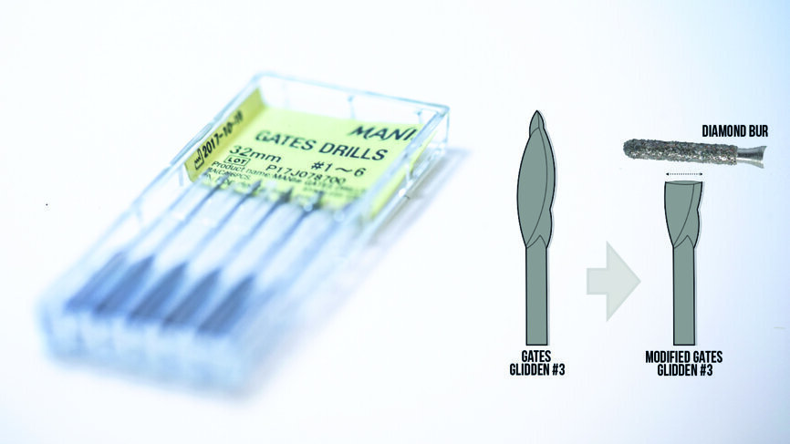 Fig. 3 : Fraise Gates–Glidden modifiée de taille 3 (modification d’une fraise Gates–Glidden avec une fraise à pointe diamantée).