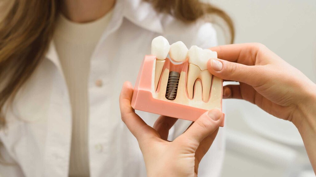 S3-Leitlinie Periimplantäre Weichgewebe-Augmentation