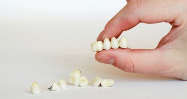 Urteil wegen zu früh eingebrachter Interimsbrücken