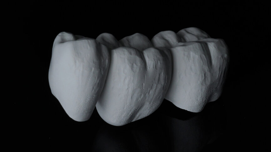 Fig. 7: Surface texturing in the pre-sintered state (prior to the final sintering procedure).