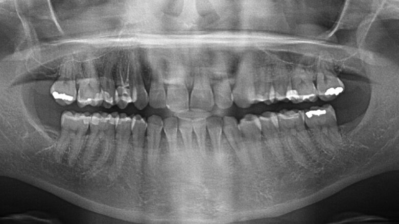 El odontólogo como auxiliar de la justicia